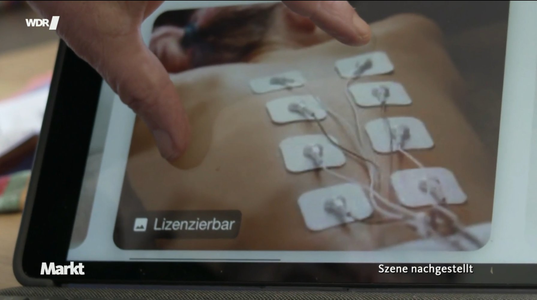 Foto einer Elektromyografie